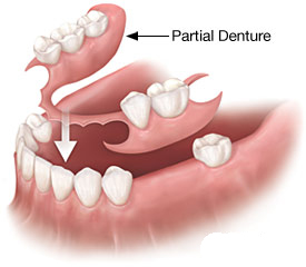 dr mancuso dentures