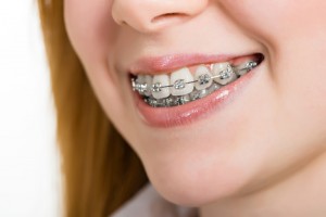 Fair Lawn Orthodontics